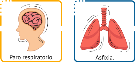 Paro respiratorio y unos pulmones con asfixia.